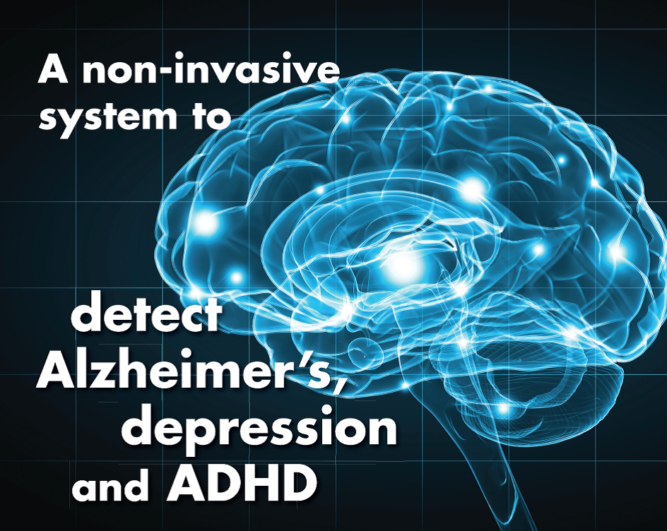 Israelul a inventat camera care citește creierul uman pentru a detecta Alzhaimerul